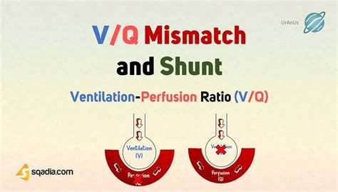 v/q ratio mismatch|vq mismatch vs shunt.